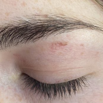 Spotlight Beauty Salon - Spotlight beauty salon, burn from wax, and scab from the multiple rips - Hair Salons Near Me - Clovis, California Spotlight Beauty Salon - Spotlight beauty salon, burn from wax, and scab from the multiple rips - Hair Salons Near Me - Clovis, California
