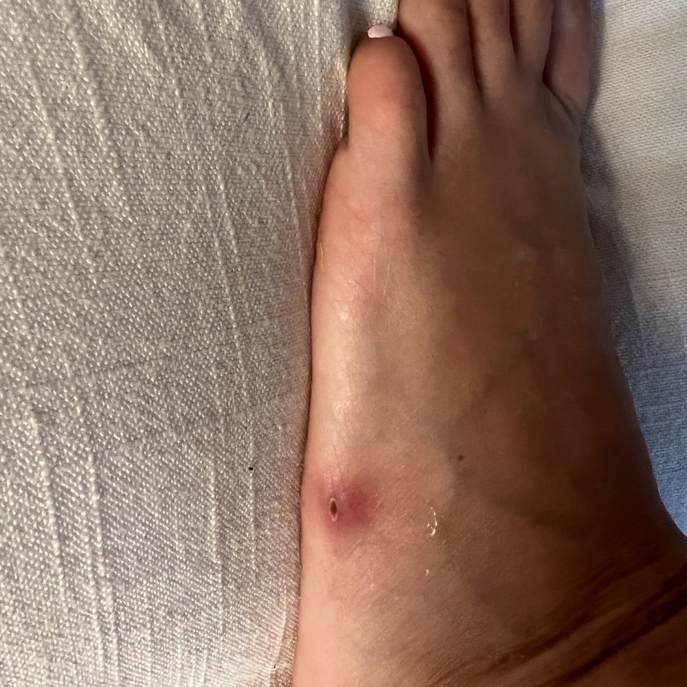 12 days later and still healing 12 days later and still healing