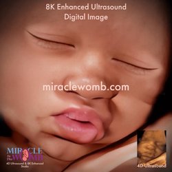 Miracle In The Womb