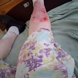 The Westchester House - My leg and now my table has been stolen and it had the only thing I had to ch a rge my phone on since my chargers keep.getting stolen