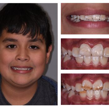 Toothopia Dental - General Dentistry Near Me - El Segundo, California Toothopia Dental - General Dentistry Near Me - El Segundo, California