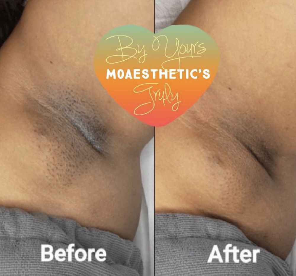 Moaesthetics Logo