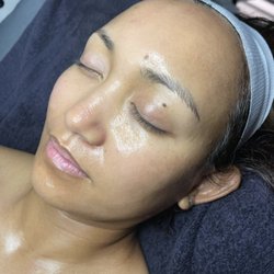 Gravitas Medspa - Glassy Skin after our Ultimate Skin Veneer Treatment