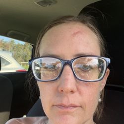 Berkshire Medical Center - No more perfect forehead