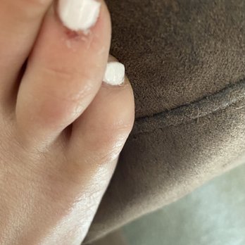 Lavender Nail Spa - Cuticle injury - Nail Salons Near Me - Vacaville, California Lavender Nail Spa - Cuticle injury - Nail Salons Near Me - Vacaville, California