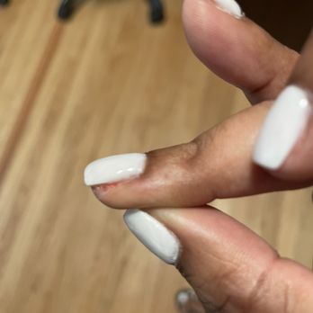 TD Nails - Bleeding - Nail Salons Near Me - Berkley, Michigan
