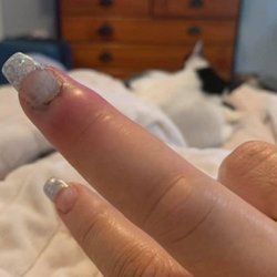Love Nails and Spa - This is a photo the day I ended up going to the ER