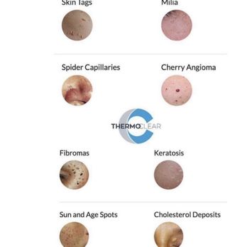 Babe Cave Aesthetics - Skin treatment - Skin Care Near Me - Edmond, Oklahoma