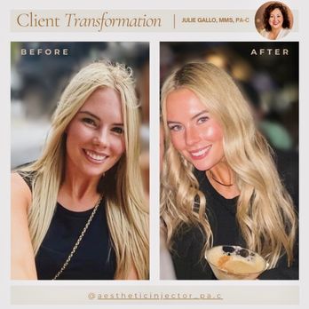Aesthetic Philosophy - Medical Spas Near Me - Charlotte, North Carolina Aesthetic Philosophy - Medical Spas Near Me - Charlotte, North Carolina