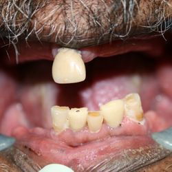 Revive Dental - Before