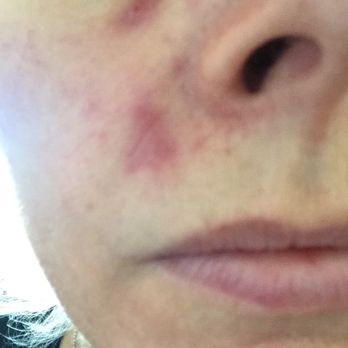 Skin Physicians & Surgeons - Dermatologists Near Me - Upland, California