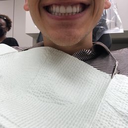 Veneers Veneers
