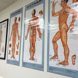 Plum FamiLee Acupuncture - Interesting Acupuncture charts! :0