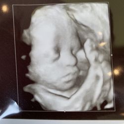 InVision 3D4D Ultrasound - Baby boy - 29 weeks