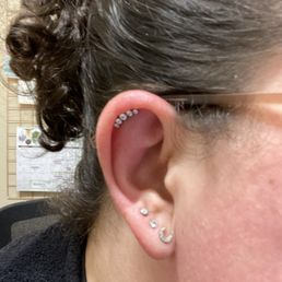 Upper helix (the ear is quite swollen due to freshness) and third lobes by Evan.