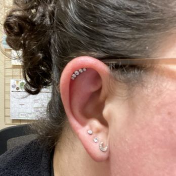 Red Room Adorned - Upper helix (the ear is quite swollen due to freshness) and third lobes by Evan. - Piercing Near Me - Chico, California