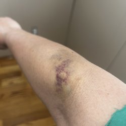 Henry Ford Medical Center - Troy - Blood draw