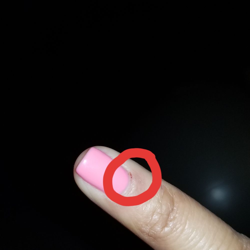 Lavish Nail Spa - This is a day later... you can see where I was bleeding (from the cuticle cut). - Nail Salons Near Me - Washington, DC, District of Columbia Lavish Nail Spa - This is a day later... you can see where I was bleeding (from the cuticle cut). - Nail Salons Near Me - Washington, DC, District of Columbia