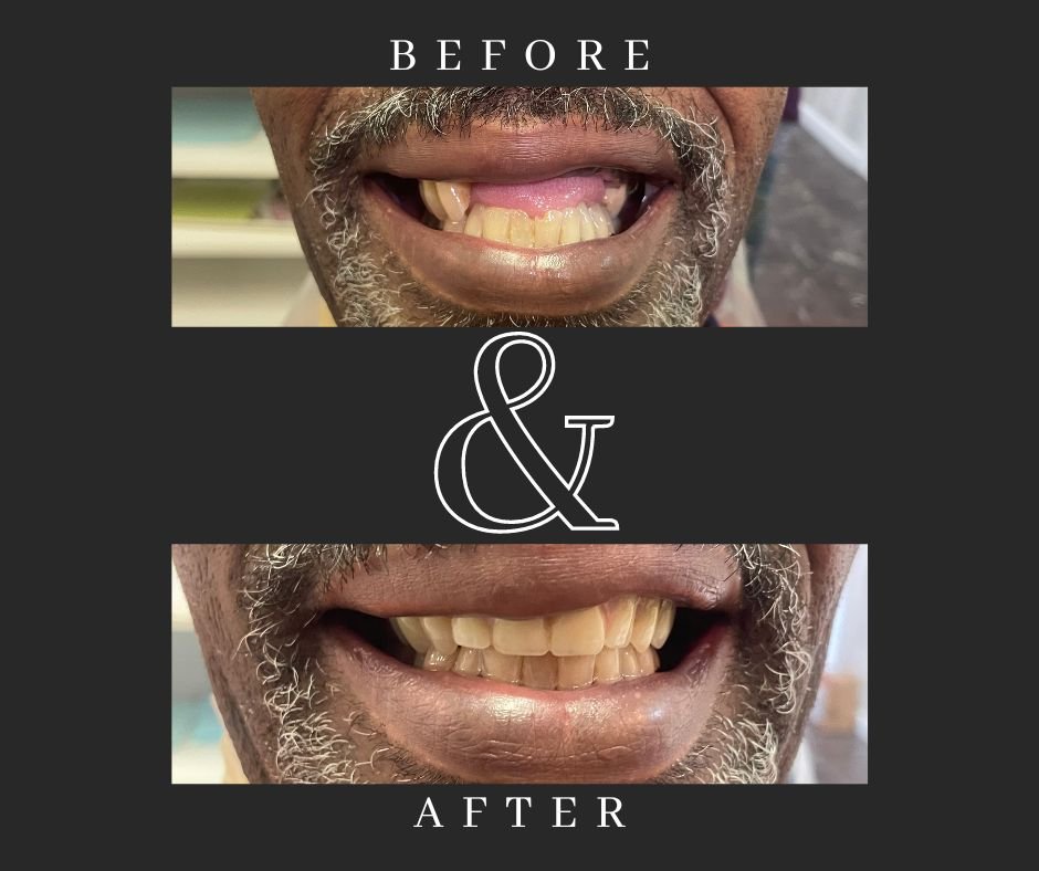 VALUE IMPLANTS AND DENTURES Updated September 2024 9510 Lanham