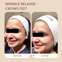 Revitalize Beauty Medspa