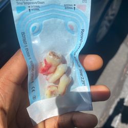 Brian B Fong, DMD, MD - My Wisdom Teeth