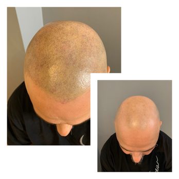 The Ink Stylist. - Hair Loss Centers Near Me - Toronto, Ontario The Ink Stylist. - Hair Loss Centers Near Me - Toronto, Ontario