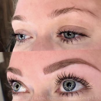 ECHO Med - Look at my before and after. Wow! Such a great job! - Medical Spas Near Me - Chandler , Arizona