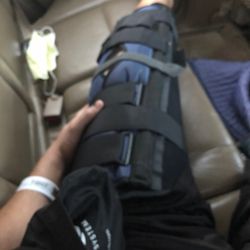 VA hospital - My broken leg