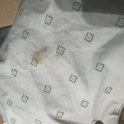 Baptist Health West Kendall Baptist Hospital - Pus and blood from belly button