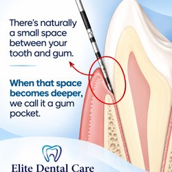 Elite Dental Care
