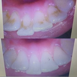 Dr Chris Ayers & Dr Melanie Davis - Standard cleaning and they got my coffee stains to go away!