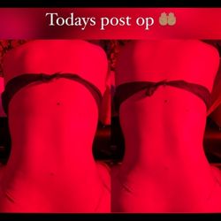Maria’s Healing Touch - Post op massage