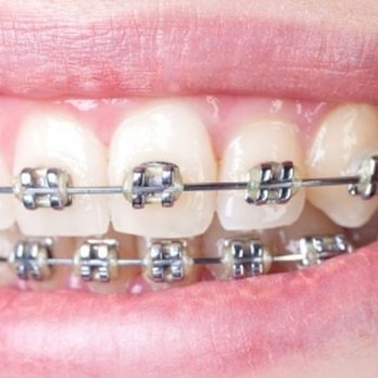 Korne Ortho - Orthodontists Near Me - Montreal, Quebec Korne Ortho - Orthodontists Near Me - Montreal, Quebec