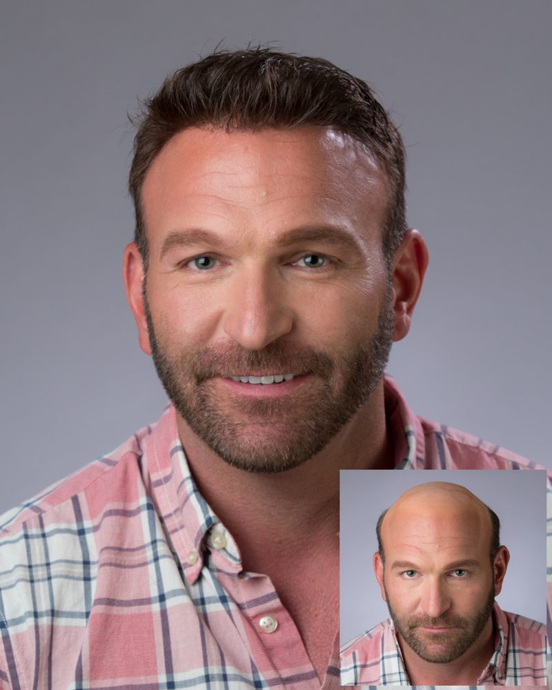 TOSIS HAIR REPLACEMENT CLINIC Updated September 2024 Request an