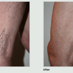 Island Vein Specialists of Mineola - Island Vein Specialists o Mineola