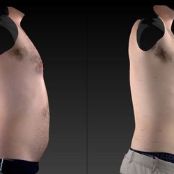 Ageless Sculpting and Wellness - 4 fat reduction sessions