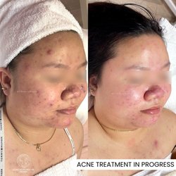 Li Beauty Medspa
