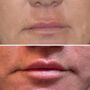 Photo of Bellevue Plastic Surgeons