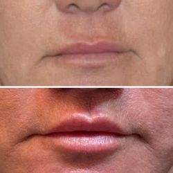 Bellevue Plastic Surgeons - Me