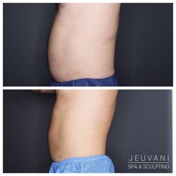 Jeuvani Spa and Sculpting - Medical Spas Near Me - Folsom, California Jeuvani Spa and Sculpting - Medical Spas Near Me - Folsom, California
