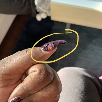 Amy Nails & Spa - This nail completely peeled off about 2hrs after gel application. - Skin Care Near Me - Boston, Massachusetts