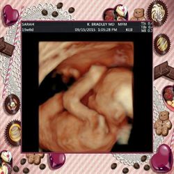 Kathleen Bradley, MD - Come see me for great baby photos