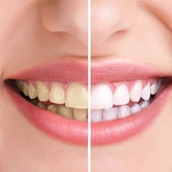 Hillside Family Dental