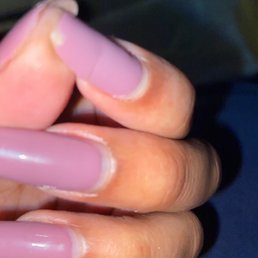Broken index finger nail Broken index finger nail