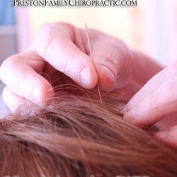 Photo of Preston Chiropractic and Acupuncture - Cary, NC, United States