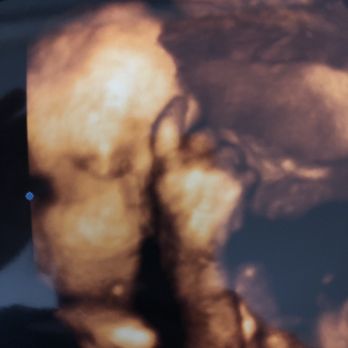 USC Fertility - Fertility Near Me - Pasadena, California USC Fertility - Fertility Near Me - Pasadena, California