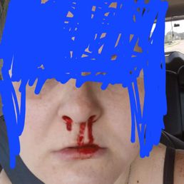 This is what happened to my daughter driving the car today when the car slammed stop and the seatbelt didn't hold again. This is what happened to my daughter driving the car today when the car slammed stop and the seatbelt didn't hold again.