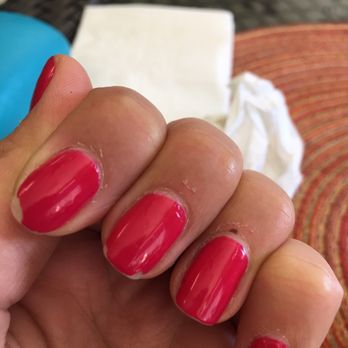 LA-OR - Bad mani job, two days later - Permanent Makeup Near Me - Arlington, Virginia