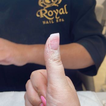 Royal Nails Spa - Fixed thumb professionally!! - Nail Salons Near Me - Livermore, California Royal Nails Spa - Fixed thumb professionally!! - Nail Salons Near Me - Livermore, California