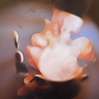 Unique Ultrasound - Diagnostic Imaging Near Me - Temecula, California Unique Ultrasound - Diagnostic Imaging Near Me - Temecula, California